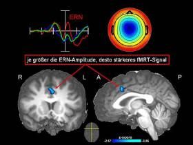 EEG (Max Planck Institut)
