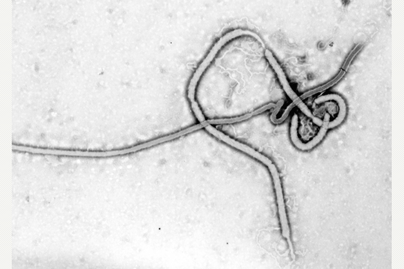 Das Ebola-Virus unter dem Elektronenmikroskop