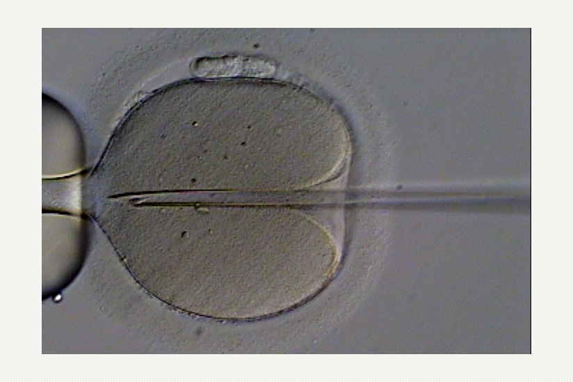 Intrazytoplasmatische Spermieninjektion