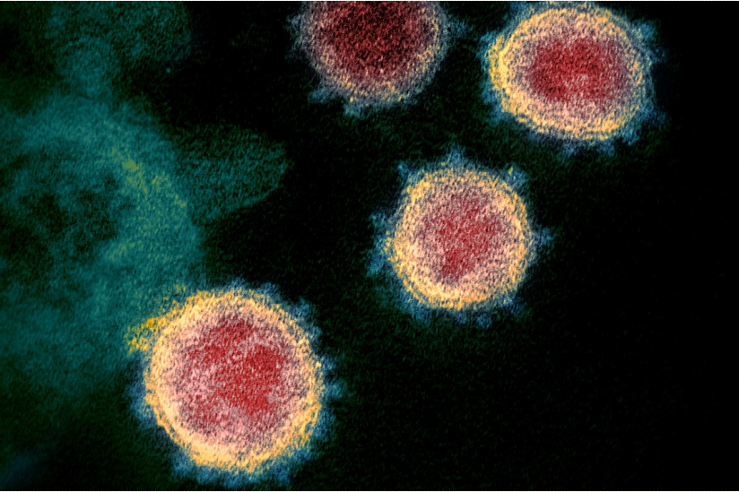 SARS-CoV-2-Virionen mit den namensgebenden "Kronen"