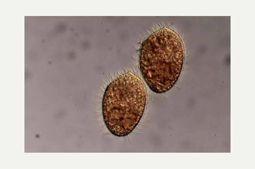 Das räuberische Wimperntierchen Tetrahymena thermophila ernährt sich von Bakterien.