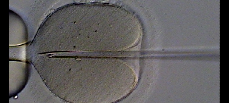 Intrazytoplasmatische Spermieninjektion