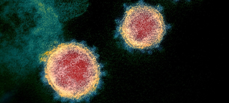 SARS-CoV-2-Virionen mit den namensgebenden "Kronen"