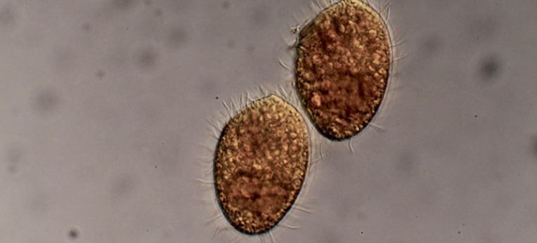 Das räuberische Wimperntierchen Tetrahymena thermophila ernährt sich von Bakterien.