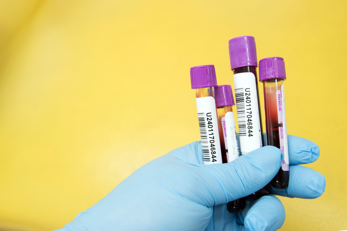 Blut-Test