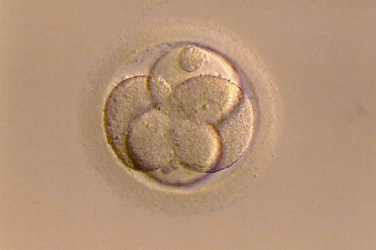 befruchtete Eizelle