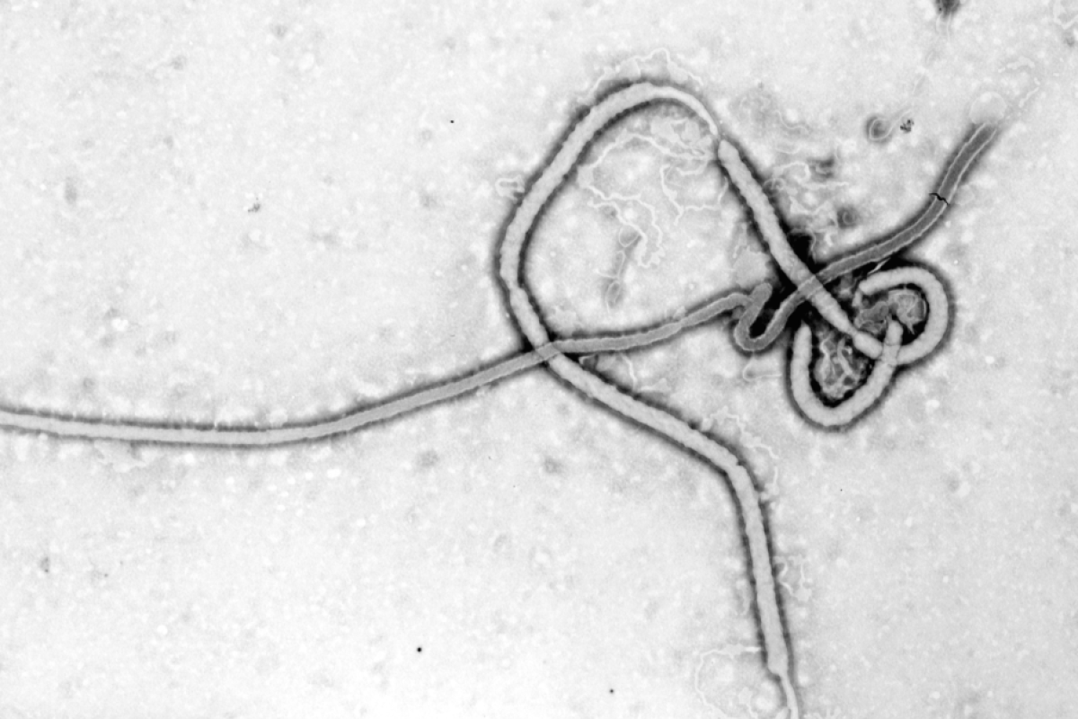 Das Ebola-Virus unter dem Elektronenmikroskop