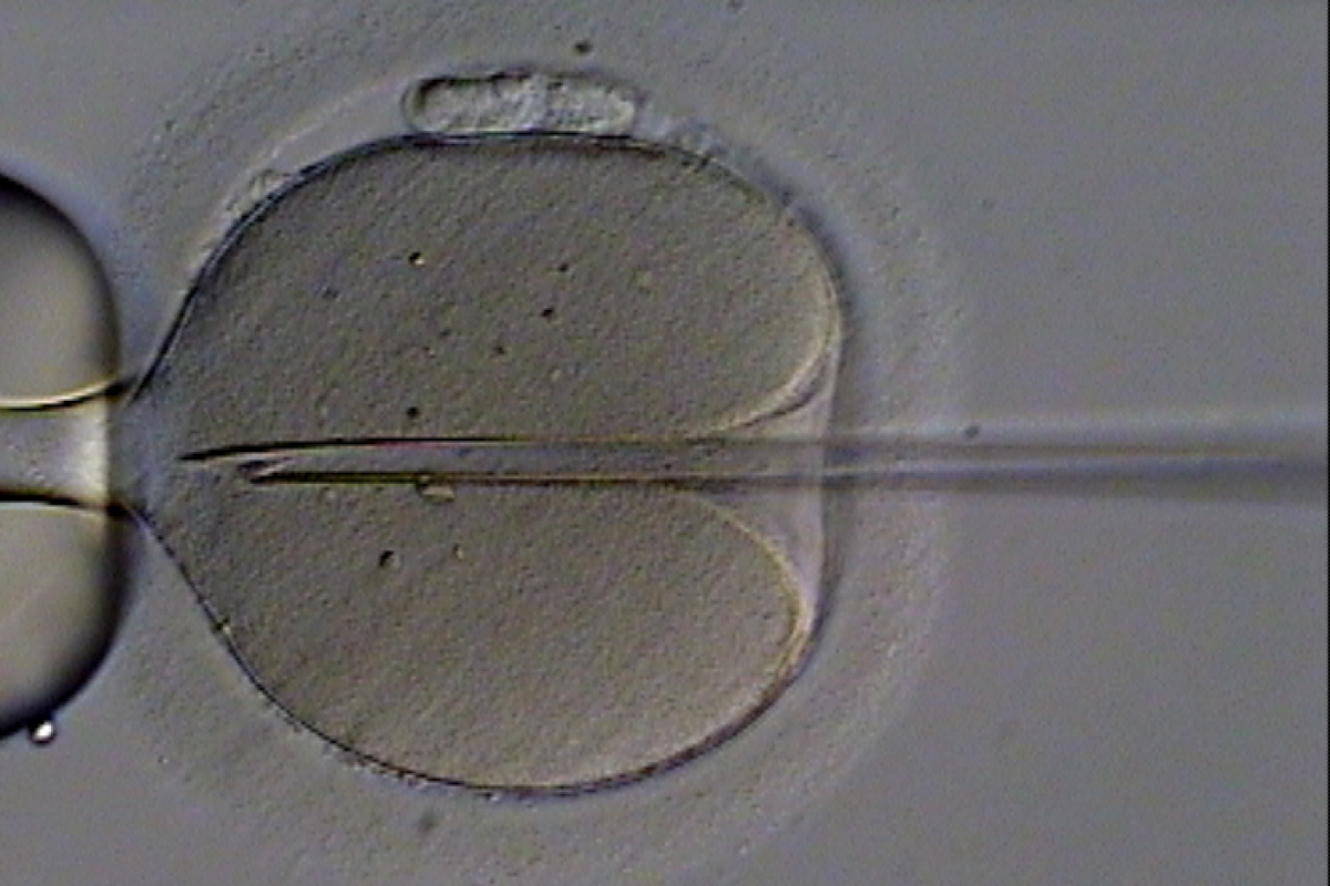 Intrazytoplasmatische Spermieninjektion